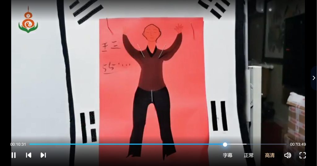 天医勾魂针全套详解视频